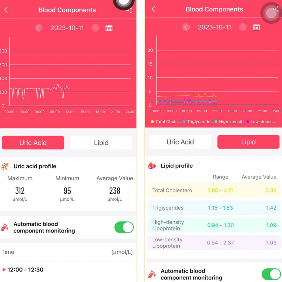 Advanced Smart Watch,1.96" IPS HD touch,Bluetooth call|Smart apps,Advanced Health monitor: ECG|Blood lipids|Uric acid|Body fat|Micro physical examination|Emotional stress detection|Non invasive blood glucose measure|Battery up to 7 days